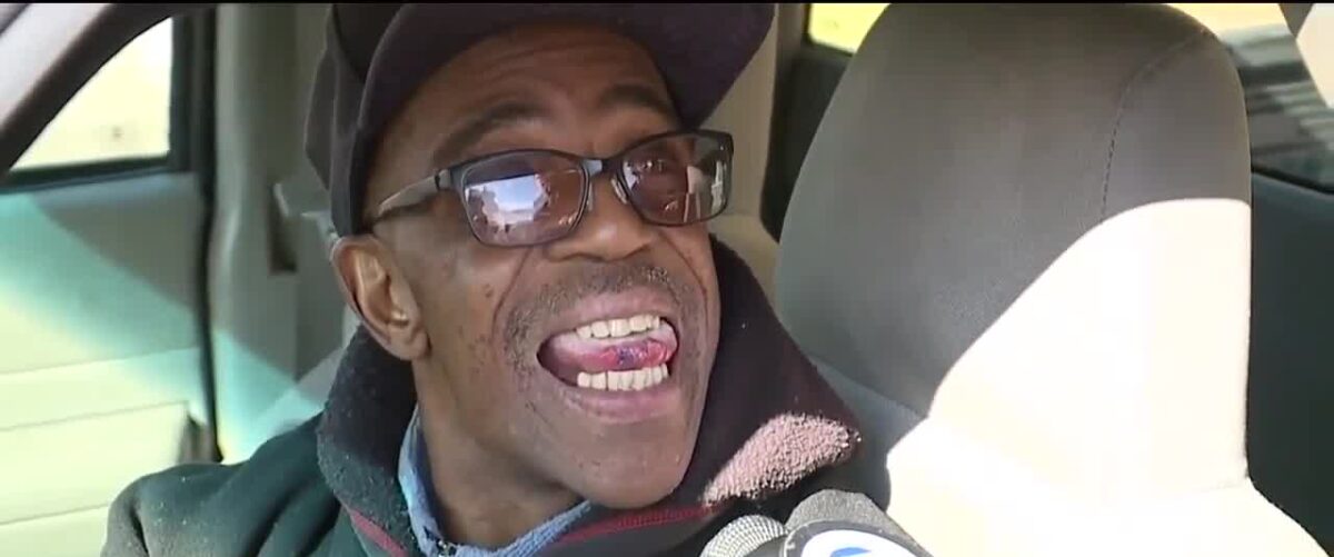 68-year-old Arthur of Center Line, Michigan, showing his tongue with the tip bitten off