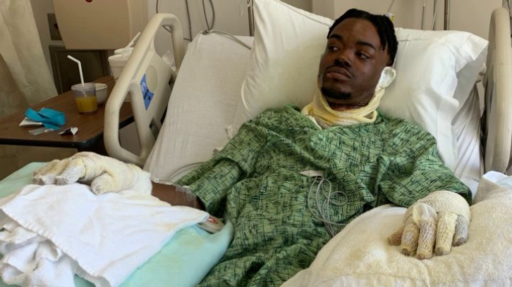 Henry Williams Jr. recovering in hospital after sustaining second- and third-degree burns