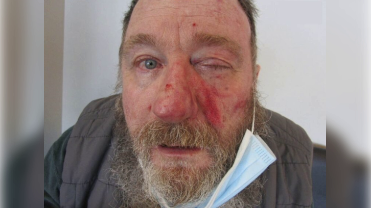 Victim Mark Dinning pictured after the brutal attack