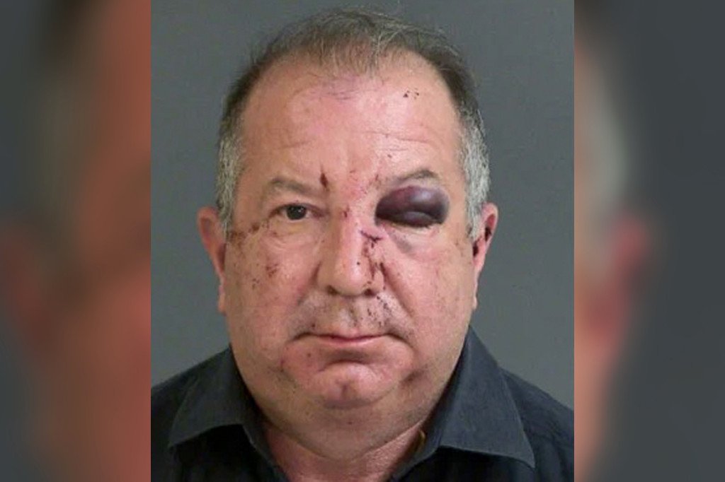 mug shot of Pano Michael Dupree showing his black eye and cuts and bruises