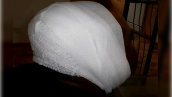 the back of Dwight Turner's heavily bandaged head