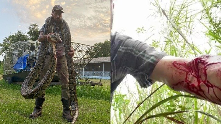 Python hunter Mike Kimmel displaying the snake he caught and his wounds