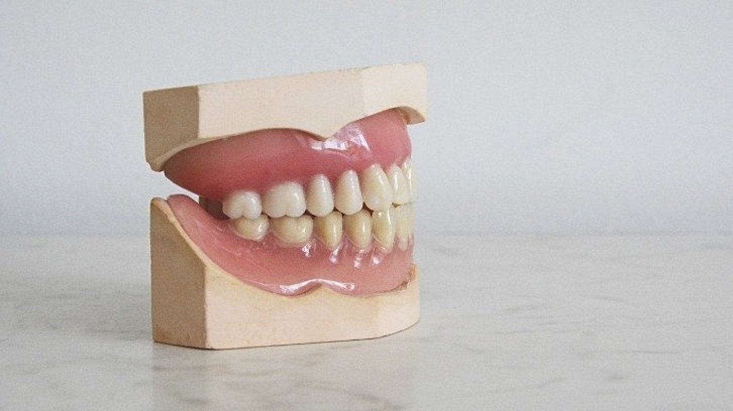 Set of false teeth